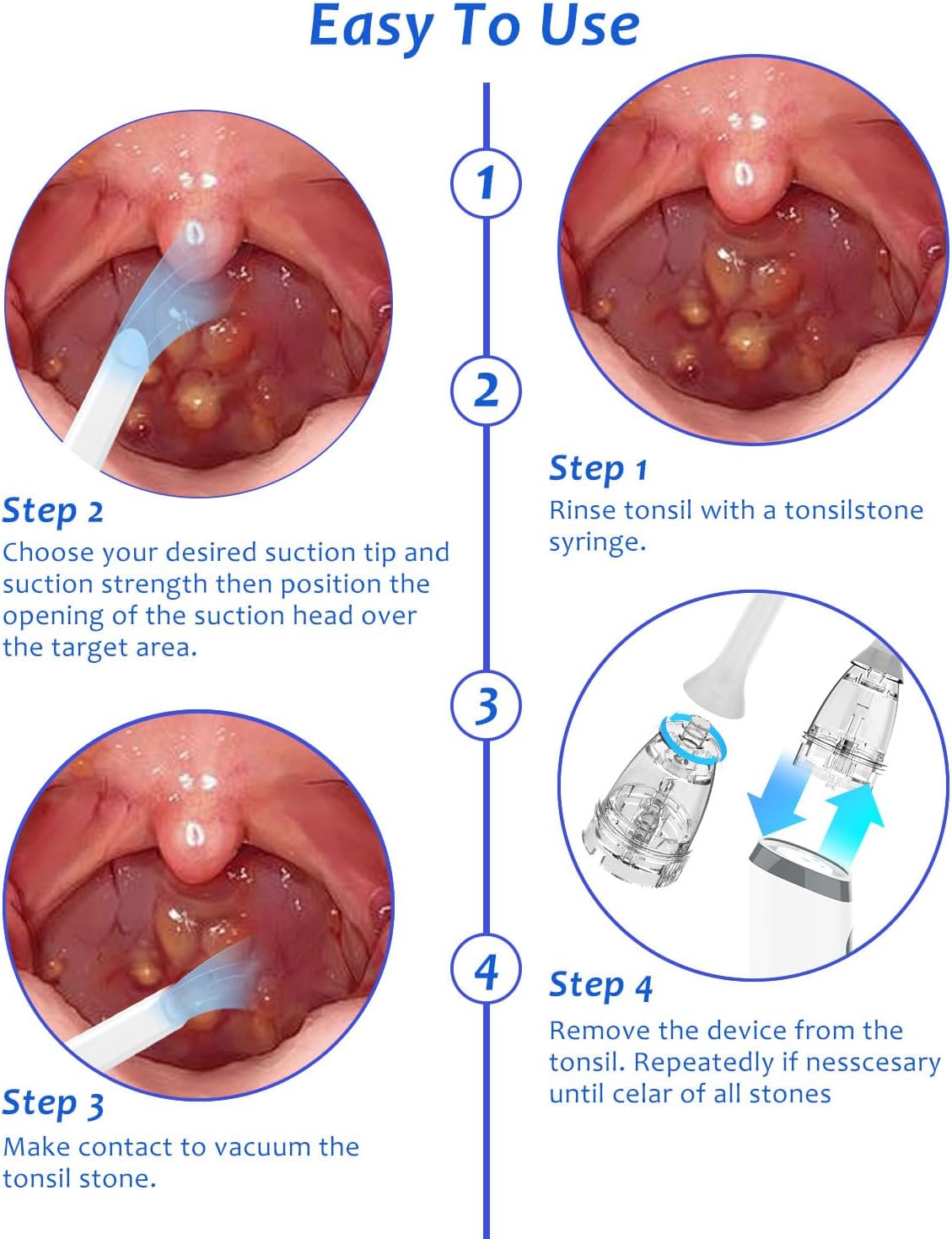 8 Zuigstanden 3 Niveaus Tonsil - Diy Electronics For Home recensie en prijs